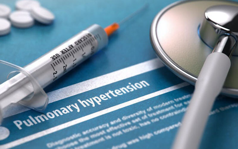 Pulmonary hypertension: why creating awareness is key in Africa