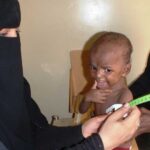 Child malnutrition reaches new highs in parts of Yemen - U.N. survey