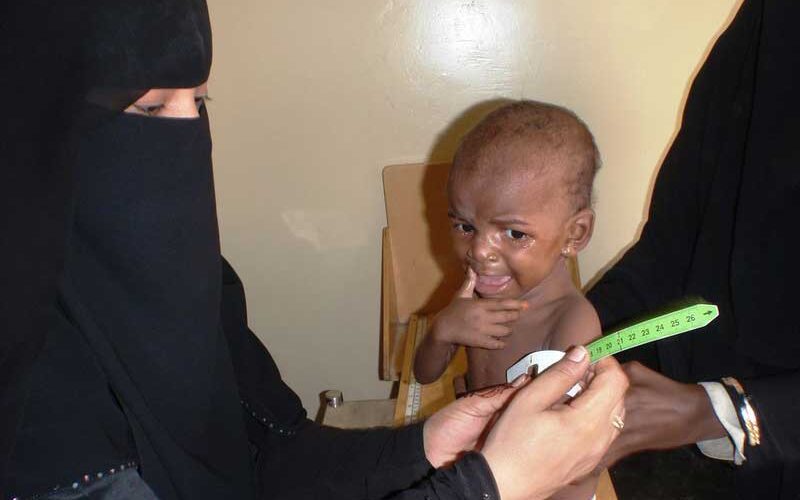 Child malnutrition reaches new highs in parts of Yemen – U.N. survey