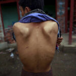Abused-boy-Hunan-Trafficking