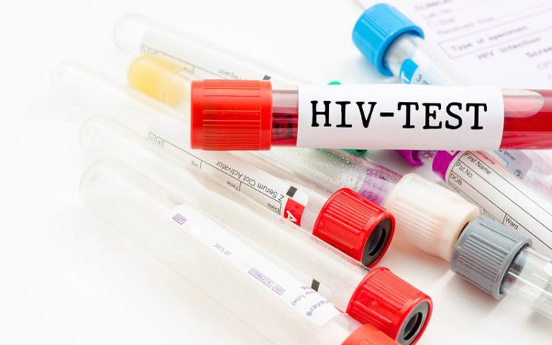 African countries differ widely in prenatal HIV testing: why it matters