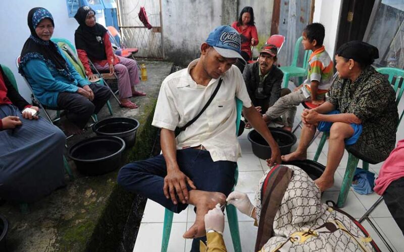 Forgotten but not gone: COVID-19 focus poses new risks to ‘invisible’ leprosy sufferers