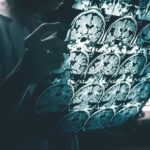 Brain-scans