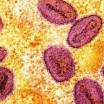 mpox virus cells