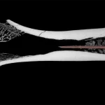 CT-scan_bovid femur