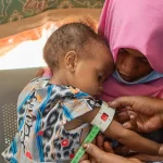 Sudan_malnutrition