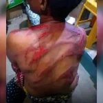 Togo_police brutality