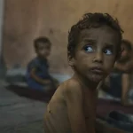 The dark history of forced starvation as a weapon of war against Indigenous peoples Gaza_malnutrition_child