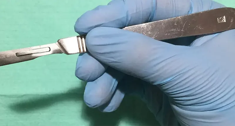 Male circumcision is made easier by a clever South African invention – we trained healthcare workers to use it
