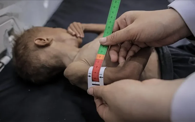 Gaza babies born into crisis as maternal malnutrition doubles low-birthweight rates