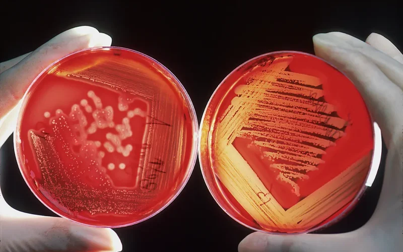 Telling people to use antibiotics responsibly isn’t enough. What will work instead