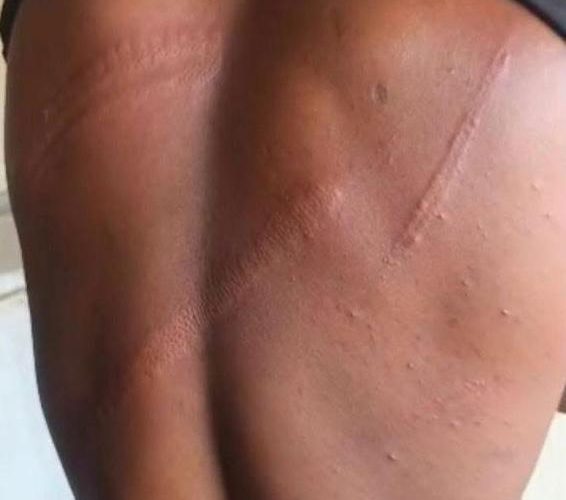 Military officers assault journalist in Ghana