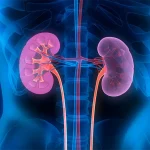 Kidney disease