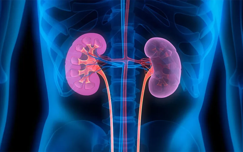 Kidney disease is growing in Africa: big new study casts light on genetic risk factors