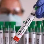 hantavirus