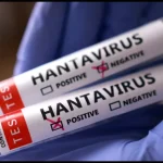 Hantavirus: Zimbabwe, South Africa move to contain a crisis - while the world watches hantavirus_testviles